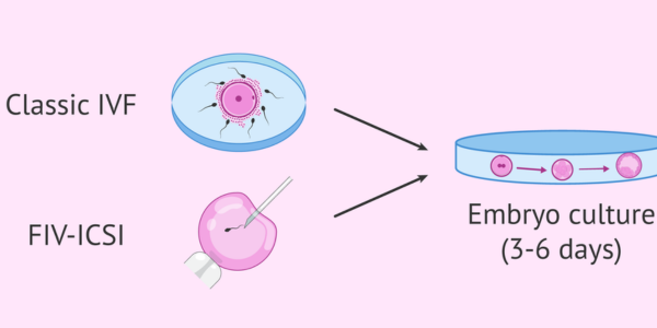 Embryo Culture