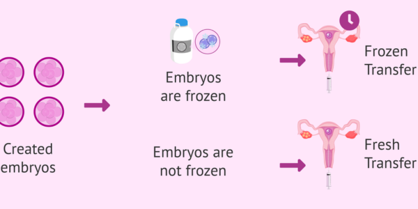 Embryo Transfer